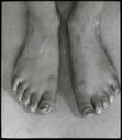 Image of Feet of Ahl-ning-wah